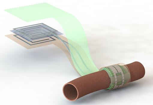 上圖描繪了這款可生物降解的壓力傳感器，它圍繞著一根血管，天線在左側(cè)(分離的層狀結(jié)構(gòu)，展示了天線結(jié)構(gòu)的細節(jié))
